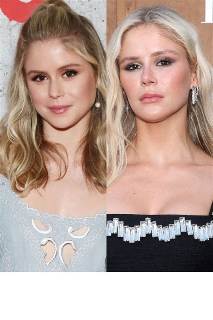 Did Erin Moriarty Get A Nose And Lips Done? Plastic Surgery